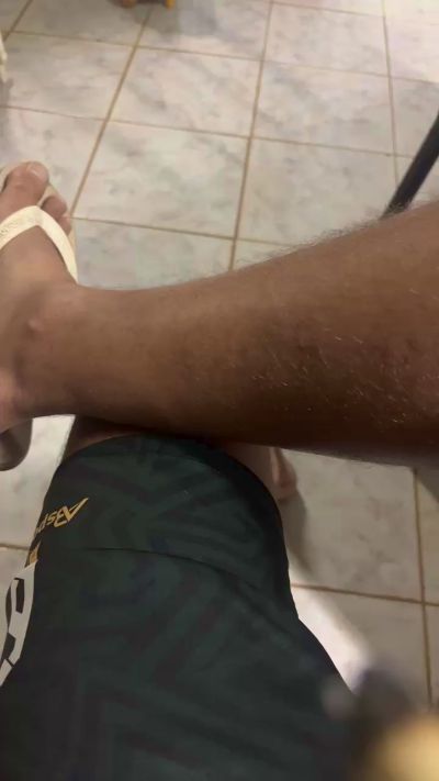 CAM4 male cam anapolinokasal