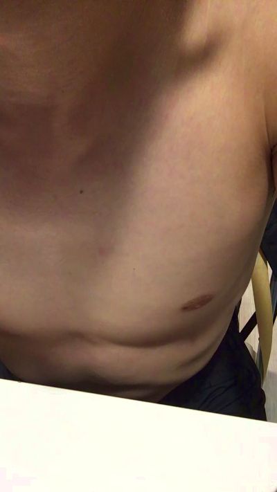 CAM4 male cam FISH_6862