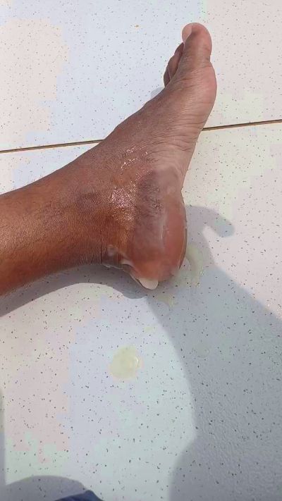 CAM4 male cam MacciSantana